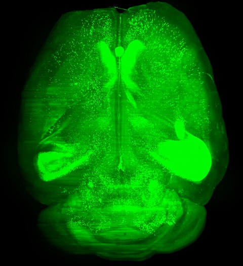 Brain-wide remodeling in alcohol dependence