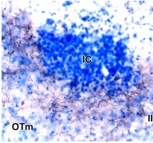 Prefrontal ensembles in alcohol withdrawal