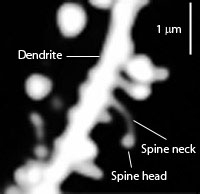 Drugs remodel dendritic spines
