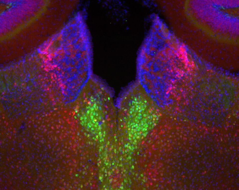 Habenular nicotinic receptors limit nicotine intake