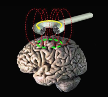 TMS tested for addiction