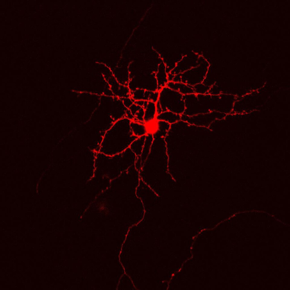 Neuronal ensembles mediate relapse