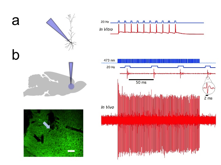 Boosting prefrontal activity prevents compulsion