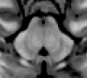 A circuit that predicts compulsive drinking