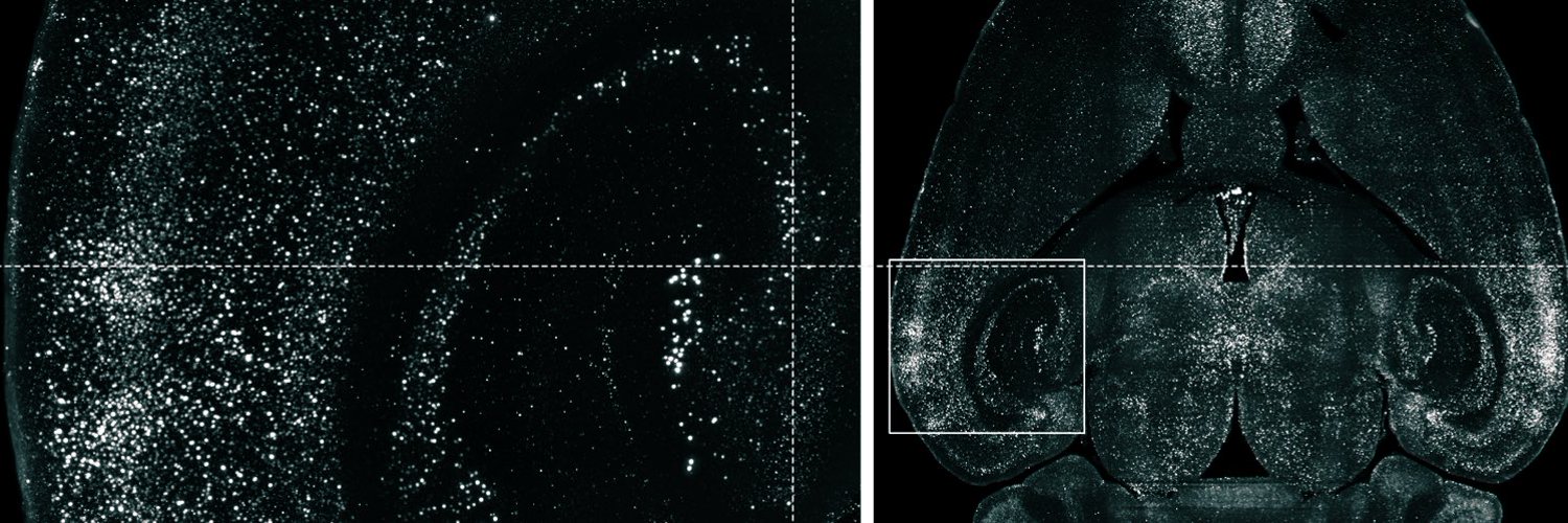 Whole-brain light-sheet imaging of neuronal activity in a cleared rat brain